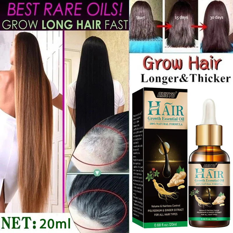 Biotin Fast Hair Growth Oil  Regrowth Serum  Thinning Treatment  c Liquid Anti=- Loss for Women & Men