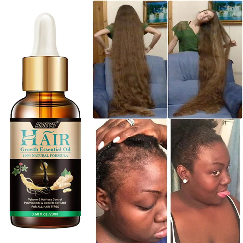 Biotin Fast Hair Growth Oil  Regrowth Serum  Thinning Treatment  c Liquid Anti=- Loss for Women & Men