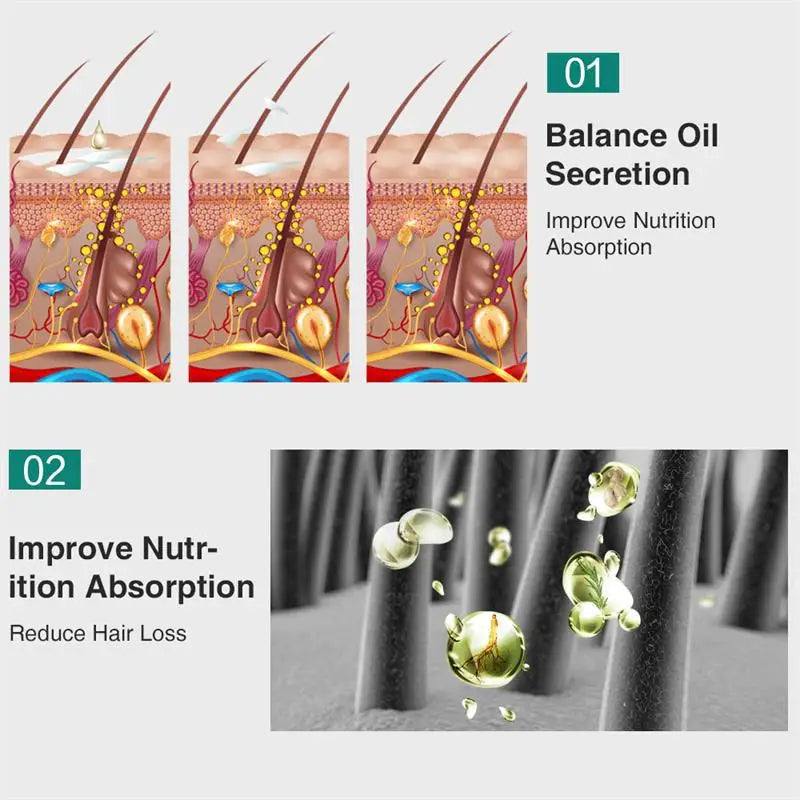 Biotin Fast Hair Growth Oil  Regrowth Serum  Thinning Treatment  c Liquid Anti=- Loss for Women & Men