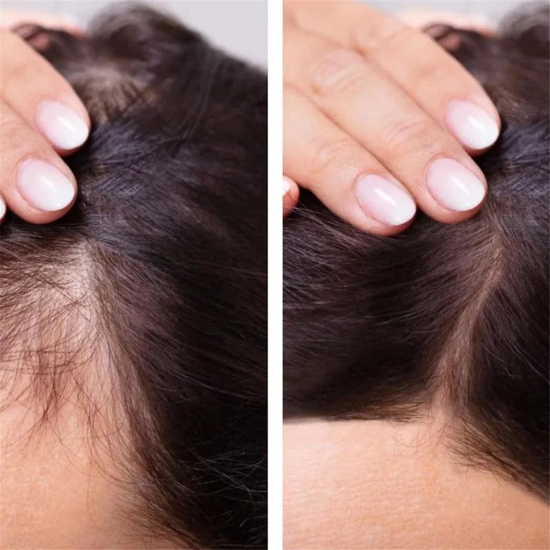 Biotin Fast Hair Growth Oil  Regrowth Serum  Thinning Treatment  c Liquid Anti=- Loss for Women & Men