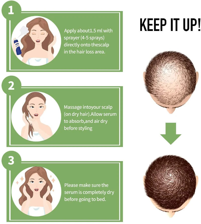 Biotin Fast Hair Growth Oil  Regrowth Serum  Thinning Treatment  c Liquid Anti=- Loss for Women & Men