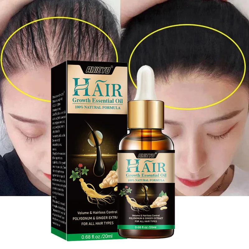 Biotin Fast Hair Growth Oil  Regrowth Serum  Thinning Treatment  c Liquid Anti=- Loss for Women & Men