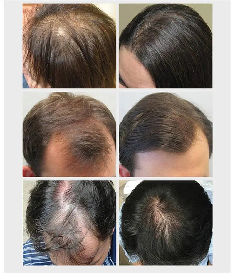 Biotin Fast Hair Growth Oil  Regrowth Serum  Thinning Treatment  c Liquid Anti=- Loss for Women & Men